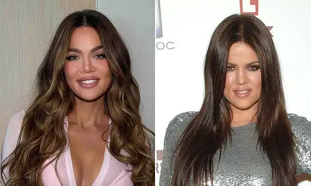 Khloe Kardashian on Cosmetic Procedures: ‘I’ve Had Enhancements’ Khloe Kardashian on Cosmetic Procedures: ‘I’ve Had Enhancements’